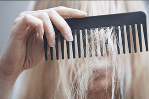Вітаміни для здорового волосся: як вони працюють та як правильно вибрати харчову добавку